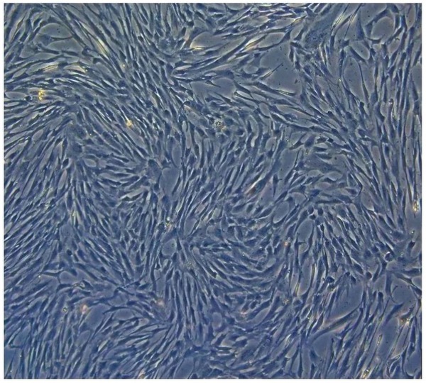 间充质干细胞形态图片